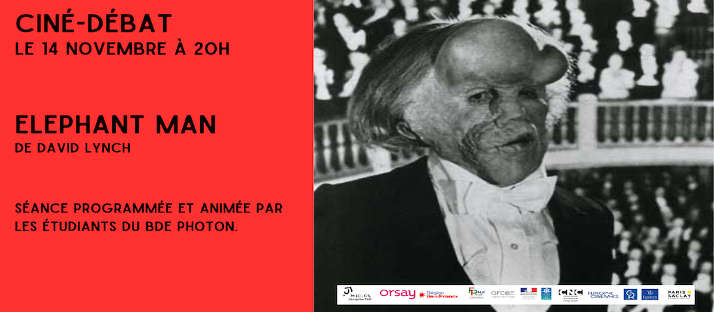 actualité 1411 Elephant man